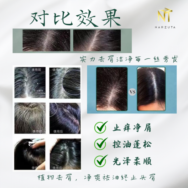 green_and_white_minimalist_new_product_skincare_instagram_post_1